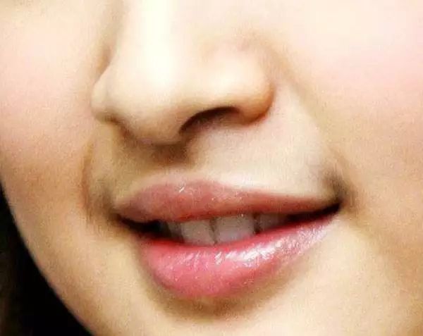 有的女生会长小胡子!是不是很尴尬,那该怎么办啊?