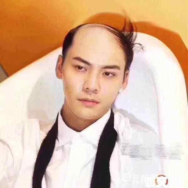 当明星们遇到地中海发型感觉还是胡歌最帅啊