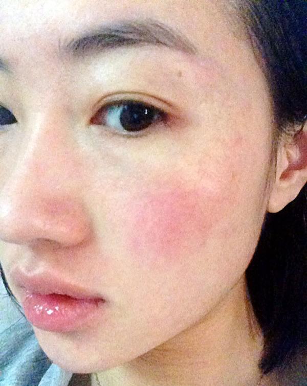 店务标准:技术之"过敏肌肤处理流程"