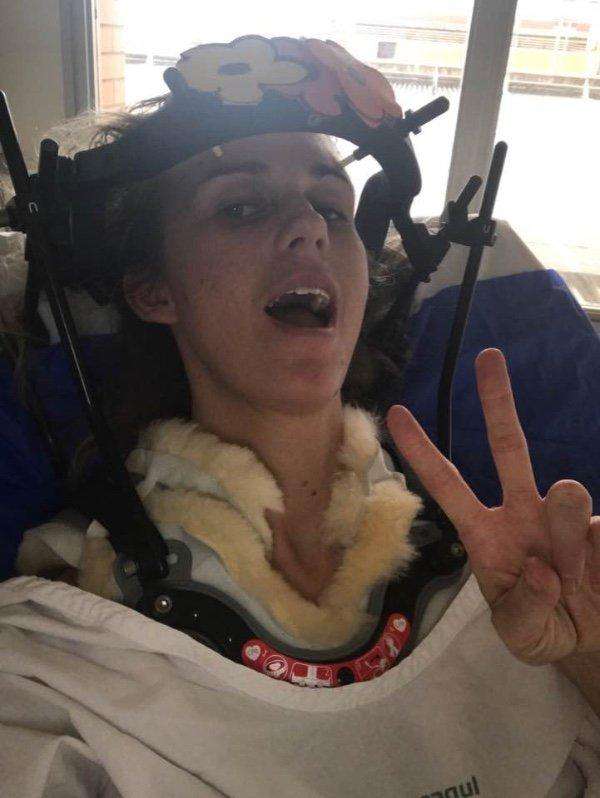 女子打个喷嚏竟把脖子弄断了打喷嚏需谨慎