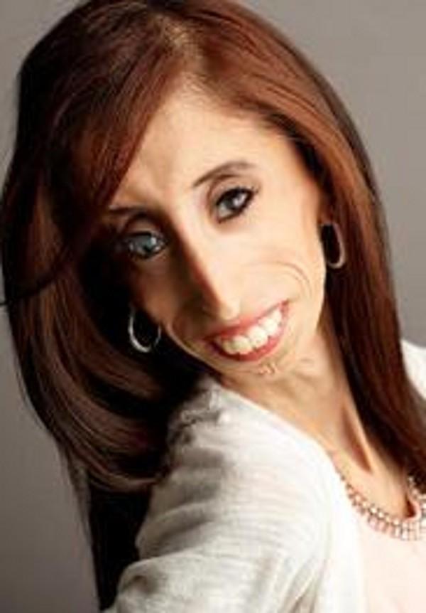 被成为 "世界上最丑的女孩",如今却现身说法,鼓舞了数百万人