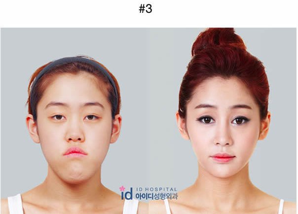 18个韩国人整形的例子,证实现在不需要投胎也能变女神!