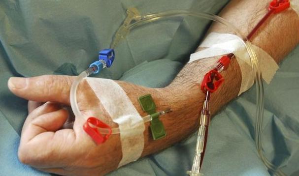 癌症放化疗效果这么好,为什么还是有很多患者过不了这一关?