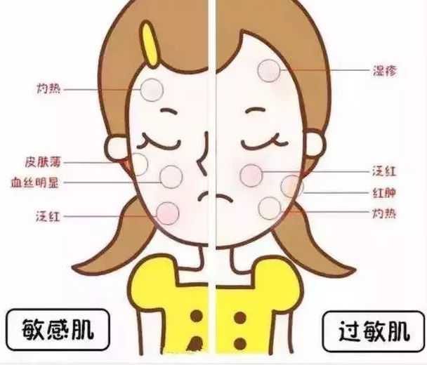 你的脸没救了!敏感性皮肤&皮肤过敏傻傻分不清-皮肤科西贝姐