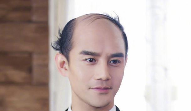 当偶像明星有了/没了头发会怎样?粉丝别看!