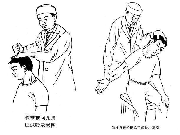 颈椎病原来是这样造成的啊,快来看看|颈椎病|颈部|椎动脉_新浪新闻