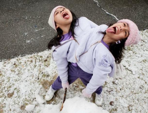 镜头下1男1女的连体人生活,是进男厕还是女厕?每次都要商量