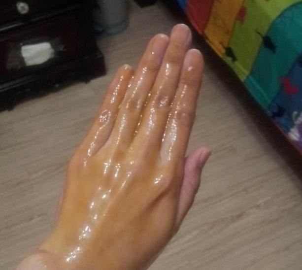 夏天手越晒越黑很难看?教你简单3招