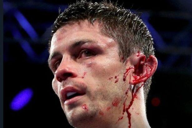 最恐怖的拳击受伤有人被打掉一只耳朵更有人被差点打掉嘴唇