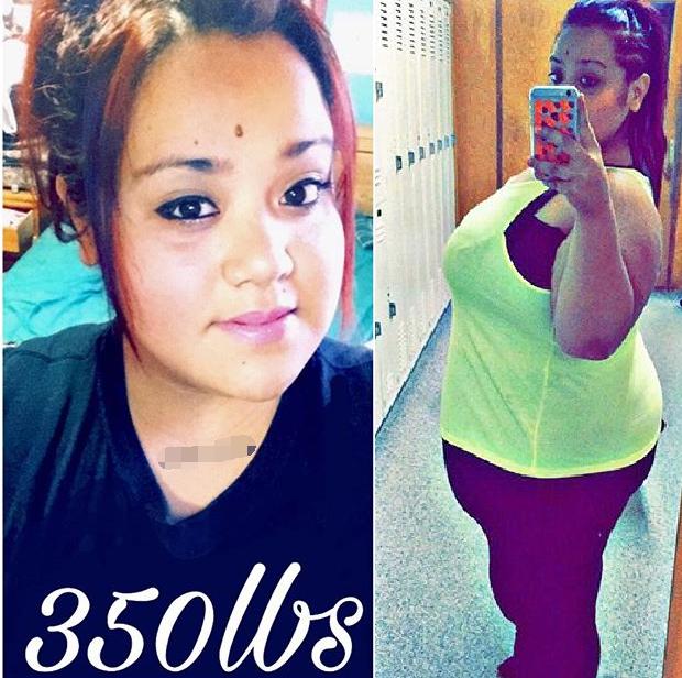 400斤女孩胖到无法站立,3年甩肉260斤,美的连妈都不认识了