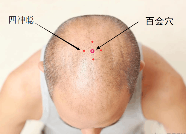 安眠药|艾灸|头顶_新浪新闻