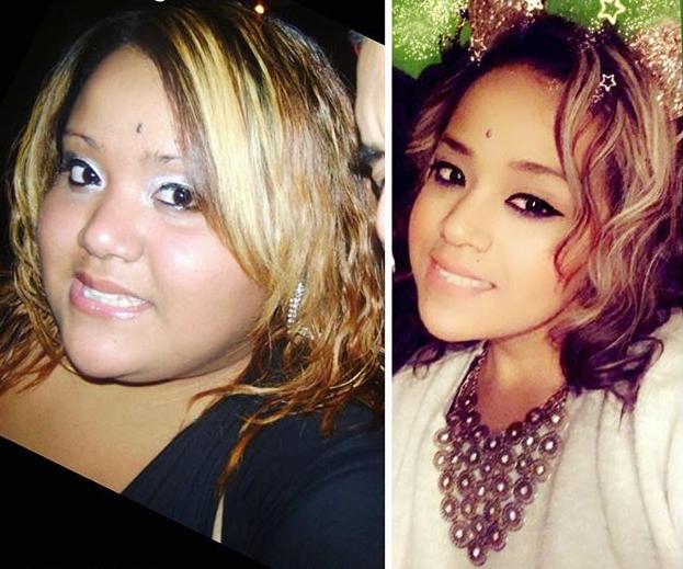 400斤女孩胖到无法站立,3年甩肉260斤,美的连妈都不认识了