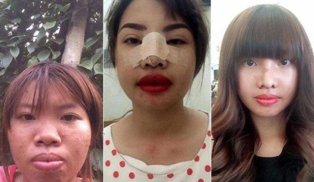 太丑没人娶,整容后从丑女逆袭成女神,成功嫁给了富二代!