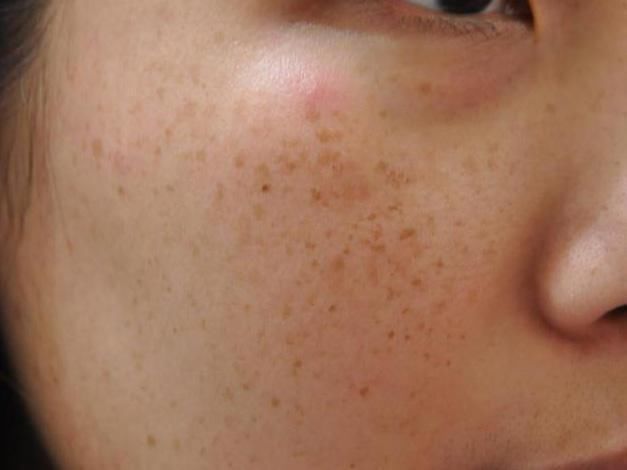 药店容易断货的它,睡前捣碎用一点,祛斑堪比美容针