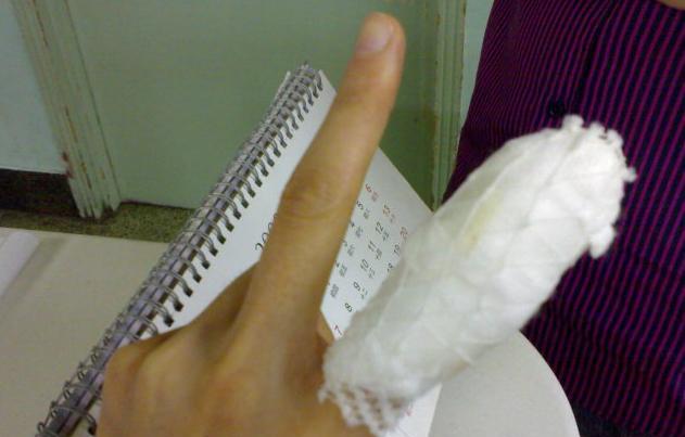 左手食指受伤包扎图片图片