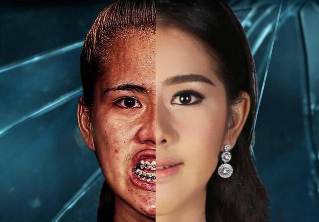 泰国女孩长相太丑一直饱受欺凌,赴韩国整容后,从丑女变成女神