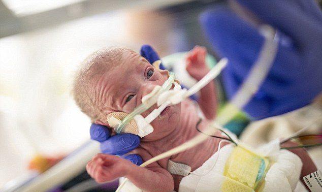 早产宝宝"大小如一罐可乐" 成功长大过圣诞模样超萌!