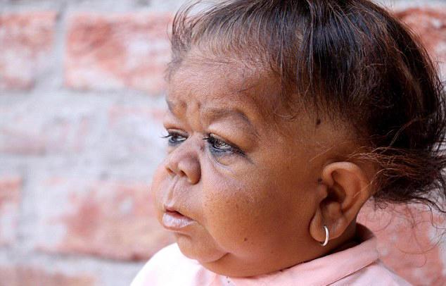 印度21岁男子患怪病,身高仅58cm,当地人认为他是神明转世