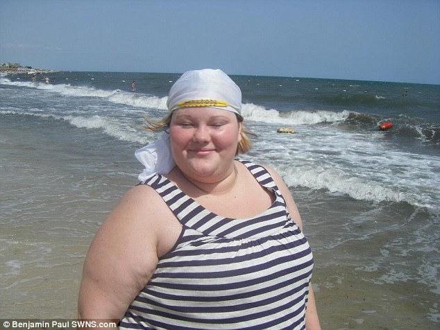 320斤胖妞减肥190斤, 身上留下12斤重的坠皮, 吓跑男友!