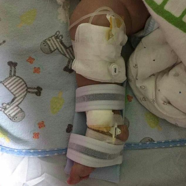 5个月宝宝得了败血症医好又复发, 一半以上的生命都是在医院度过