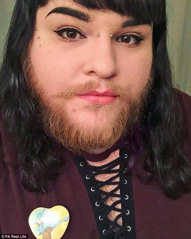 26岁多毛症女遇见真爱 交往6年的"她":她的胡子很有吸引力