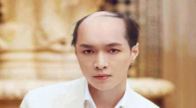 当明星们遇到地中海发型,感觉还是胡歌最帅啊!__财经头条