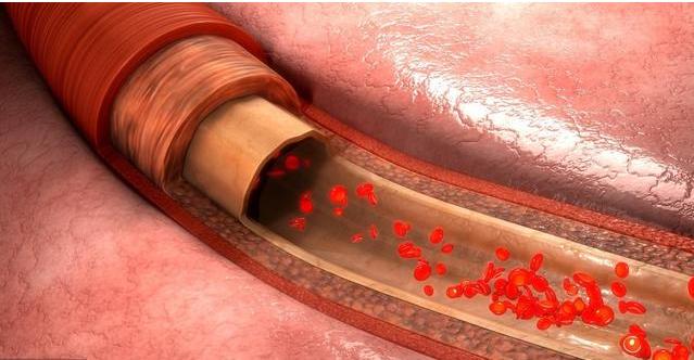 老中医:1种食物,吃着就能清通血管防脑梗,花小钱治大病