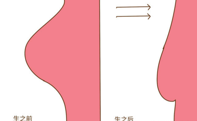 生过孩子的女人和以前相比有什么变化?从头到脚都不一样
