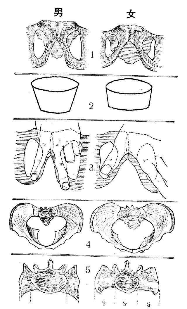 上图很明显——1,坐骨耻骨枝:男性的粗壮;女性的弱.