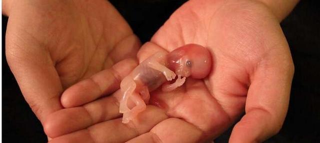 怀孕后想知道婴儿性别,检查单上有这四个字,是男孩的几率大