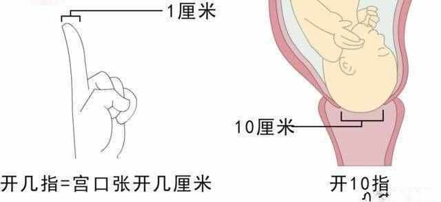什么是胎儿入盆和开宫口? 你可能不知道!