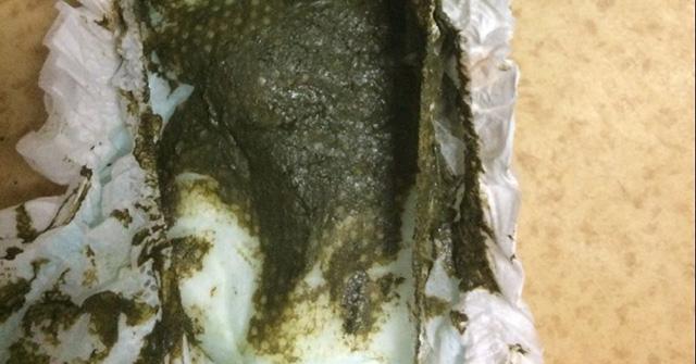 到了第三天下午拉了一滩黑乎乎的便便,类似新生儿出生头几天的"脐屎"