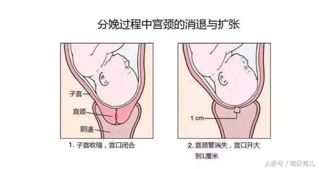 其实不是的,"开十指"就是宫口扩张10厘米,正常的话,我们每个人的手指