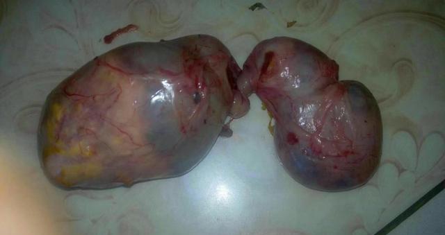 大庆一农民得"鹅宝"价格百万?希望有人帮忙"鉴宝"