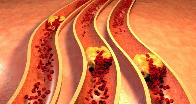 血液|饮食|粘稠度_新浪新闻