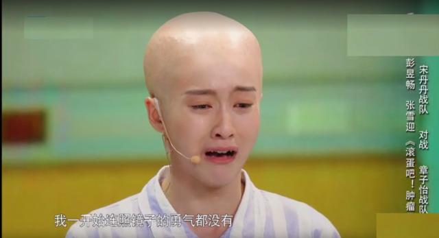 张雪迎为戏变光头,被集体大赞演技好