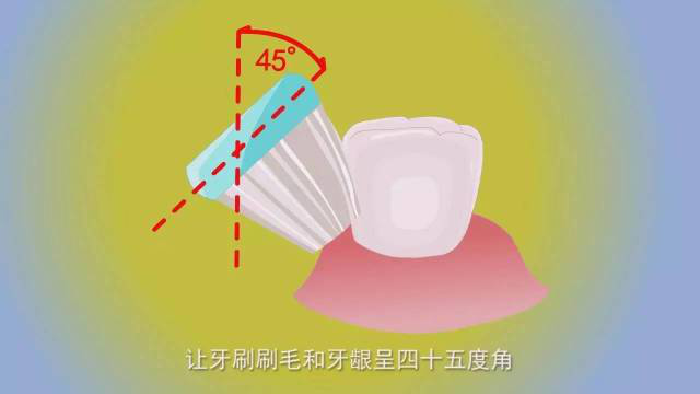 "持":指的是刷牙要持之以恒用45度角刷毛轻压牙齿,覆盖一点牙龈水平短