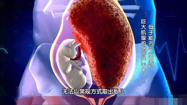 产妇孕7个月产检,医生当即要求手术,剖开肚子后医生却汗如雨下