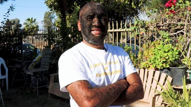 现实版狼人98的身体覆盖着毛发是世界上毛发最旺盛的人