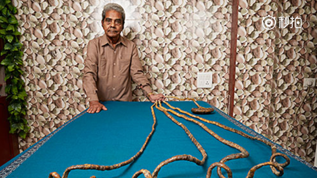 印度男子左手五指指甲留了62年,是世界最长指甲,长达9.09米