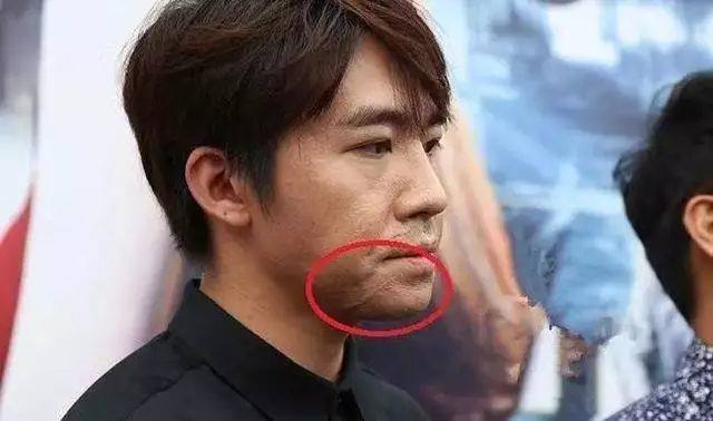 这10位明星脸上都有疤,郑爽被怀疑整容,杨幂自拍只爱拍半边脸!