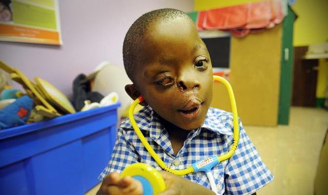 到时候病毒不仅伤害胎儿的中枢神经系统,严重还会造成流产,畸形