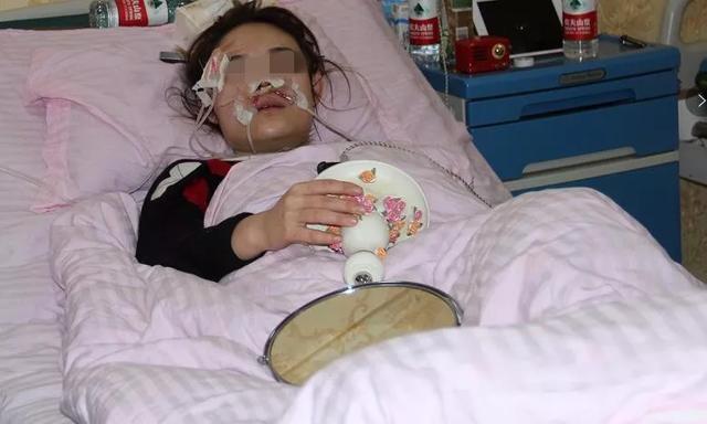 25岁美女街边摸流浪狗, 被咬毁容