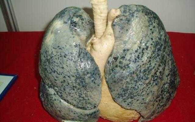 不吸烟的肺部图片图片