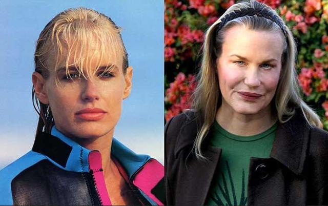 十位整形失败的外国名人, 但有些能力依旧不会被掩埋