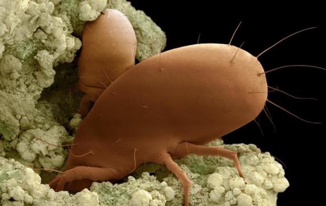 面部黑头多毛孔粗,可能是它造成,2对策很快正常|螨虫|毛孔|黑头_新浪