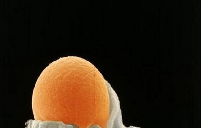 卵子长什么样图片真实图片