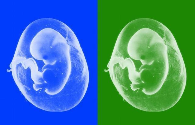 胎动竟然跟胎儿性别也有关系,准爸爸准妈妈看看