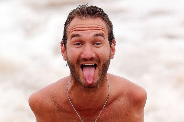 "海豹人"刚出生父亲都呕吐,母亲4个月才敢抱他,现成励志讲师