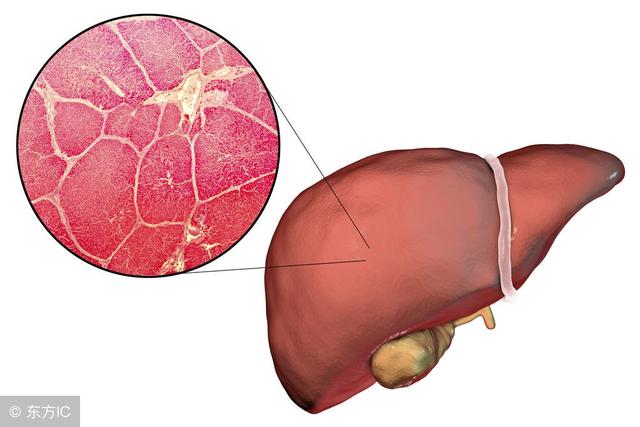乙肝复查4点发现早期肝脏炎症